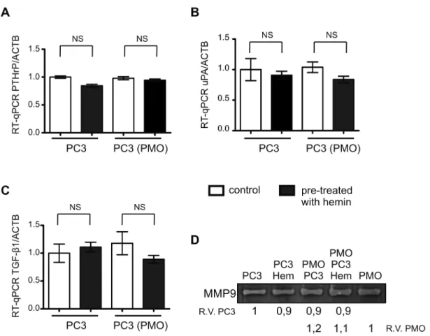 Figure 4.  The expression of genes implicated in osteoclasts modulation is not altered in PC3 cells by co-culturing with osteoblasts