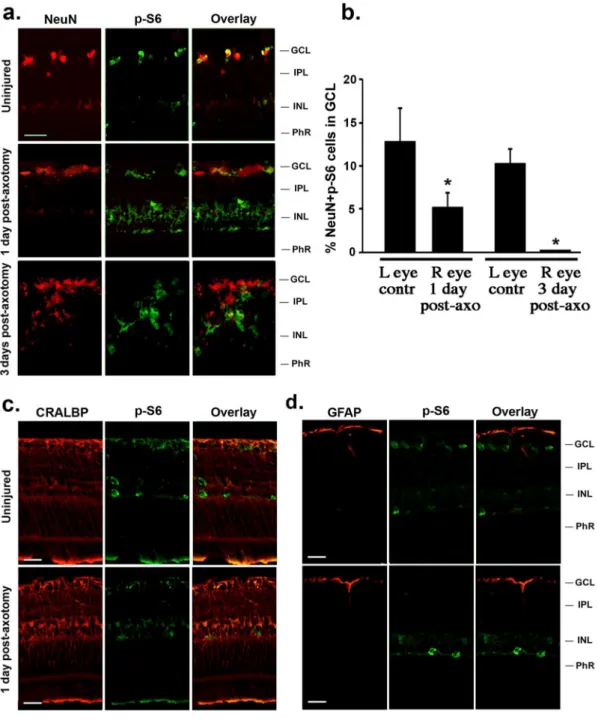 Figure 1. Expression of phospho-S6 (p-S6) decreases in the GCL after axotomy. (a) p-S6 immunoreativity in neurons of the GCL