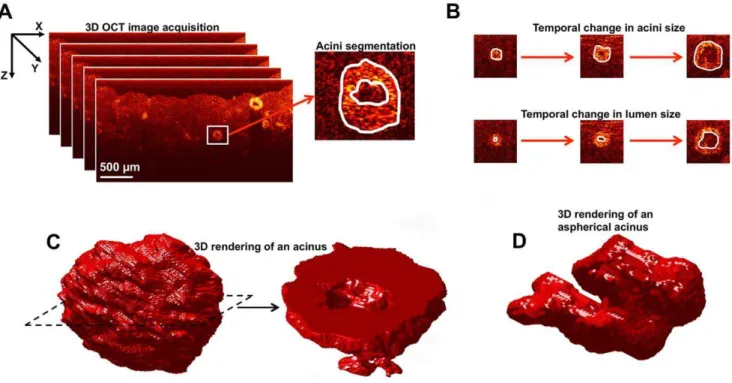 Figure 1. 3D-OCT image acquisition of the co-cultures, and analysis of the shape and size of acini