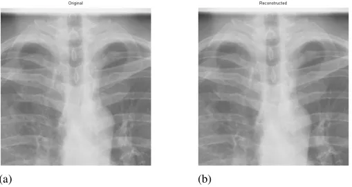 Figure 4.  Biomedical image -zoomed by 2 using row-wise decomposition  a)   Original image b) decompressed image 