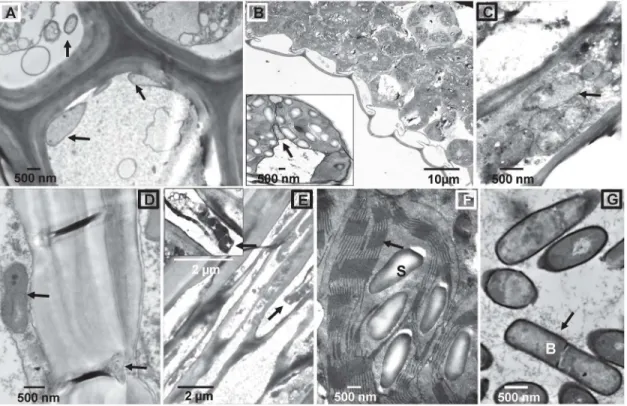 Fig 3. Transmission electron microscopy (TEM) micrographs of colonized Brachypodium tissues with B