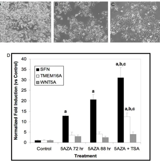Table S5 Genes significantly decreased in expression, 468LN vs 468GFP. Expression microarray (HGU133 Plus_2) data were prefiltered to remove genes changing less than 2 fold, and an ANOVA was run to determine significant (p ,0.05) changers