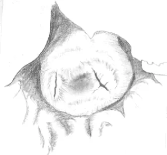 Figura 8: Esquema con cámara clara de la  superfiie exocervical de M. coypus. Se  observan las dos aberturas externas de los  canales endocervicales