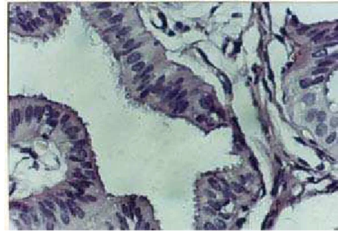 Figura 5: Microfotografía del epitelio de  revestimiento de la ampolla del oviducto  de M