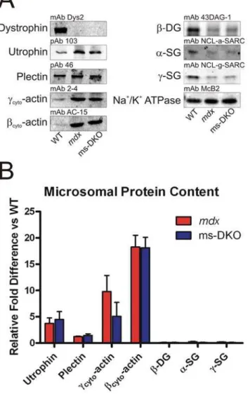 Figure S1 Localization of cytoplasmic actins in mdx quadriceps sections. (A) Ten micron thick sections from mdx quadriceps stained with laminin and cytoplasmic actin antibodies