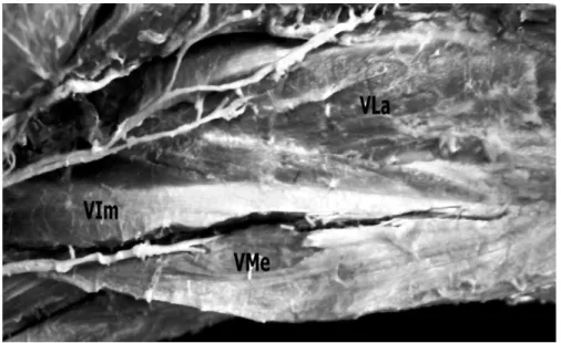 Figura 4  –  Fotografia dos músculos da coxa do tamanduá bandeira,  vista  cranial  profunda  (foto  com  músculo  reto  femoral  rebatido)