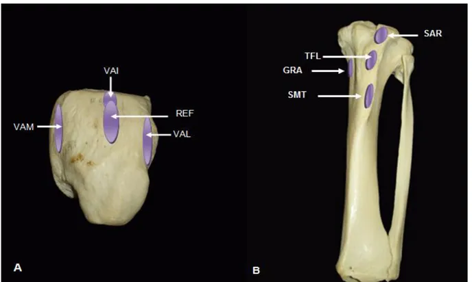 Figura 6  –  Fotografia do fêmur de Tapirus terrestris. Origens (azul) e inserções (roxo) dos  músculos da coxa
