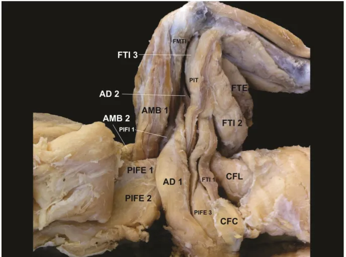 Figura 6. Fotografia dos músculos da cintura pelvina e estilopódio do antímero esquerdo de  C