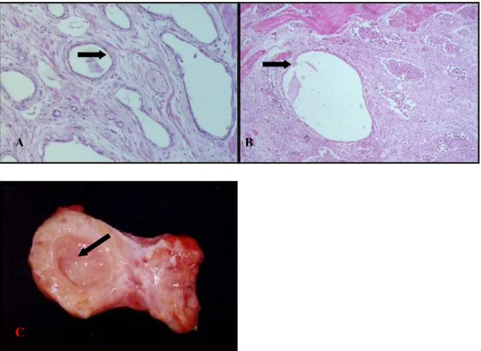 Figura  5.  Fotomicrografias  (A  e  B)  de  glândulas  próstatas  de  cães  não  orquiectomizados  com  hiperplasia cística