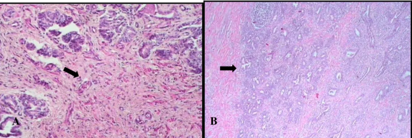 Figura  8.  Fotomicrografias  de  glândula  próstata  de  cão  orquiectomizado  com  hipoplasia  do  tecido  prostático