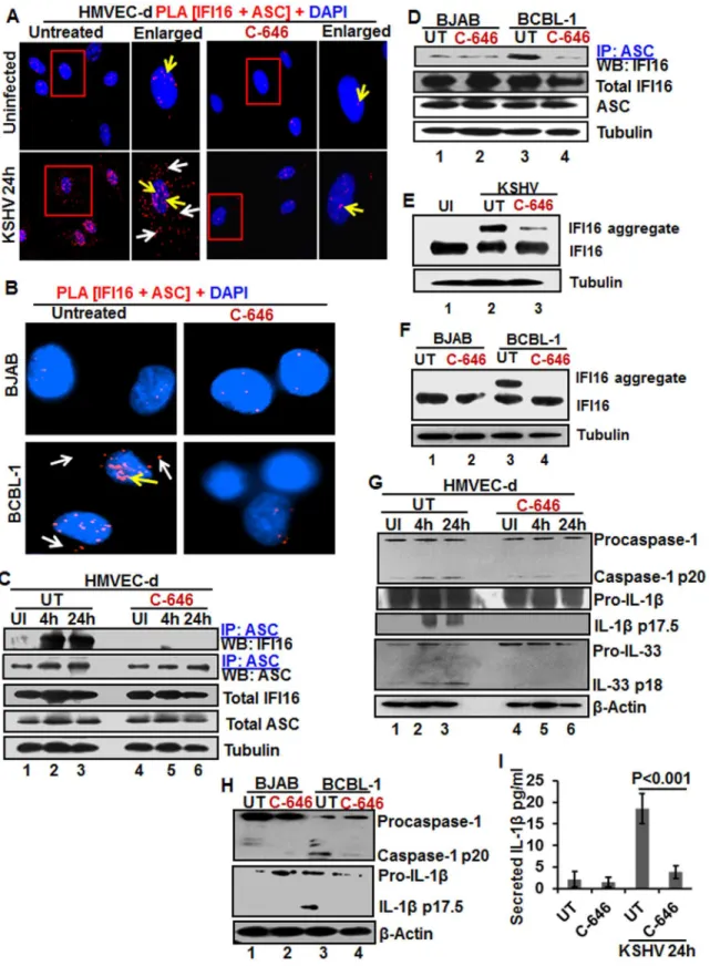 Fig 4. IFI16-ASC inflammasome formation, IFI16 aggregation and consequences during de novo KSHV infection in the presence of C-646