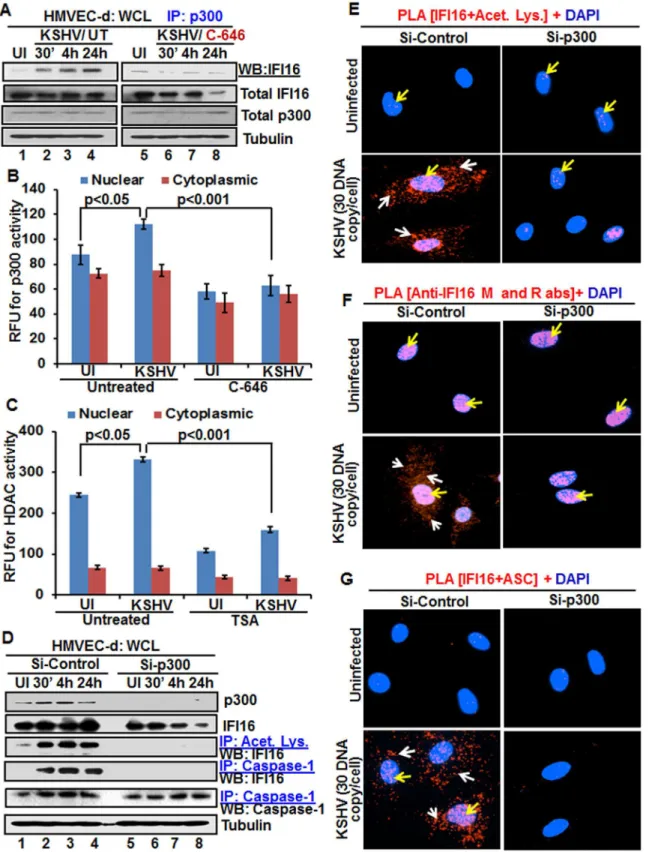Fig 6. Effect of acetyltransferase p300 knockdown on IFI16 acetylation and IFI16 inflammasomes during de novo KSHV infection of HMVEC-d cells
