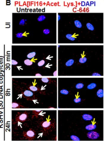 Fig 2. Proximity Ligation Assay (PLA) of IFI16’s acetylation and cytoplasmic redistribution during de novo KSHV infection of HMVEC-d cells