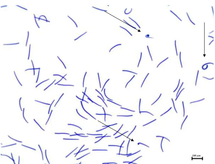 Figura 5: Esfregaço de espermatozoides de perus hidrolisado em ácido clorídrico 1N por 10  minutos e corado em cubeta com azul de toluidina 0,025%, pH4,0 por 20 minutos e posterior  desidratação em  série de concentração crescente de álcool