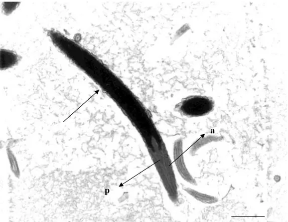 Figura  1:  Eletromicrografia  de  espermatozoide  de  peru  em  corte  longitudinal  observa-se  pequeno ponto de  alteração da cromatina  (seta sem letra), considerado como baixo nível de  alteração  da  cromatina,  nota-se  presença  do  Perfuratorium  