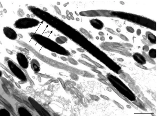 Figura 2: Eletro micrografia de espermatozoide de peru em corte longitudinal onde se observa  três  pontos  de  alterações  (setas),  considerado  como  nível  médio  de  alteração  da  cromatina  (Barra   2 µm).