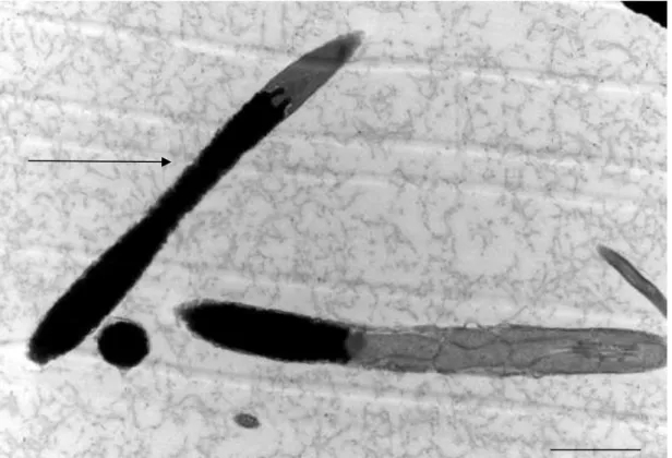 Figura 4: Eletromicrografia de espermatozoide de peru em corte longitudinal onde se observa  compactação cromatínica normal