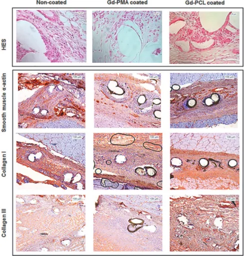 Fig 4. Histological images of the explanted meshes. Upper panel: Standard histological results at day 30 of Hematoxyline Eosine and Safran (HES) stained sections of non-coated mesh (control group I), Gd-PMA coated mesh (experimental group II) and Gd-PCL co