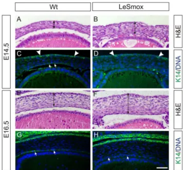Figure 10. Altered cornea development in LeSmox eyes.