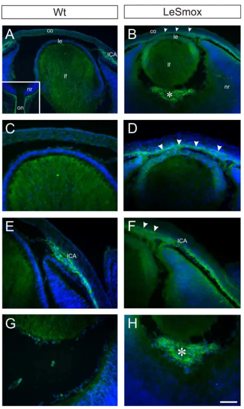 Figure 11. Abnormal migration of Nrp2 + cells in LeSmox eyes. Nrp2 immunofluorescence in frozen sections from Wt (A, C, E, G) and LeSmox (B, D, F, H) eyes at E14.5
