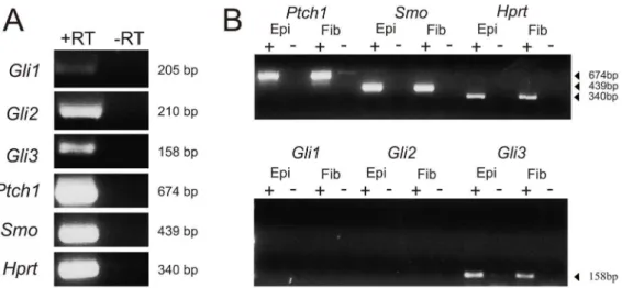 Figure 2. Localization of Hh pathway in lens. Immunolocalization of Ptch1 (A, D, G), Gli2 (B, E, H) and Gli3 (C, F, I) and non-immune IgG control (inset D), in developing lens at E12.5 (A–C), E13.5 (D–F) and E15.5 (G–I)
