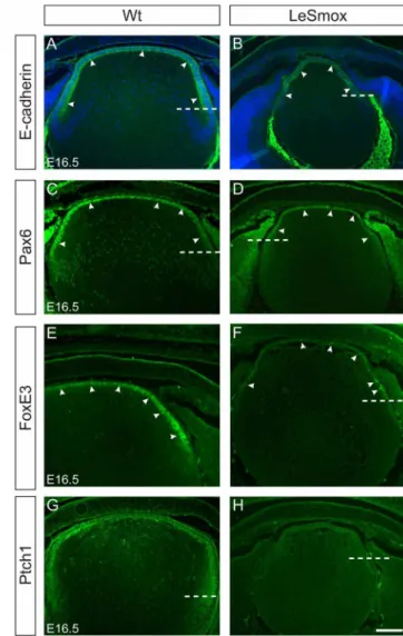 Figure 6. Expression of epithelial cell markers in LeSmox lenses. Expression of E-cadherin (A, B), Pax6 (C–D), FoxE3 (E–F) and Ptch1 (G, H) proteins in Wt (A, C, E, G) and LeSmox (B, D, F, H) lenses at E16.5