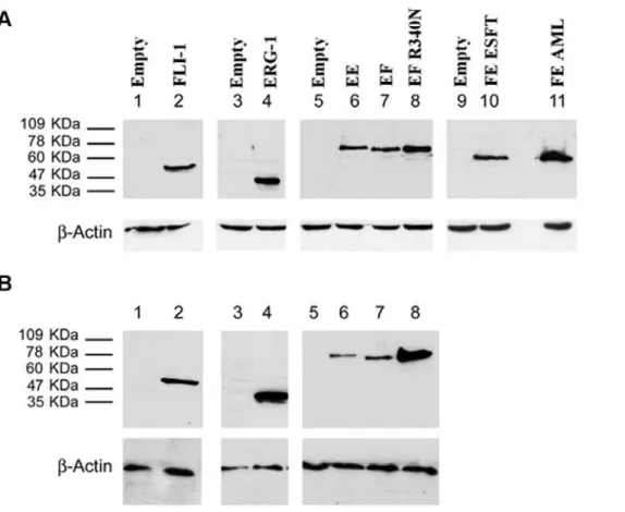Figure 2. Phenotype of mouse MPCs infected with EWS-FLI-1, EWS-FLI-1 R340N mutant, EWS-ERG, FUS-ERG ESFT, FUS-ERG AML, ERG-1, FLI-1 or an empty pMSCV puro vector