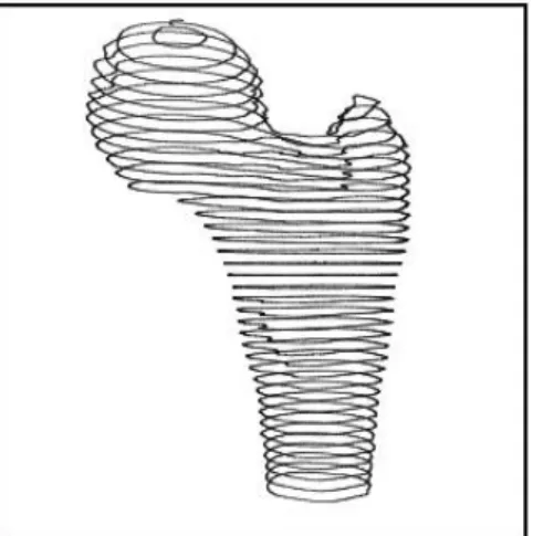 Figura  2.1  -  Pilha  de  seções  planares  obtidas  por  Tomografia  Computadorizada  (HOPPE,  1994) 