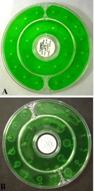 Figura 1. A. Placa antes da adição de soros teste e controle. B. Halos de diferentes diâmetros                                 que foram obtidos após a adição dos soros teste com diferentes concentrações de                                  IgG e dos soros 