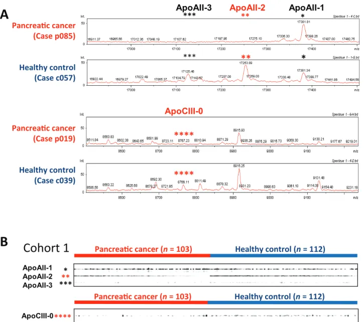Figure 2. oMALDI-QqTOF-MS profiling of plasma proteins. (A) Spectra for representative pancreatic cancer patients and controls within the ranges 16,900 to 17,500 m/z (top) and 8500 to 9250 m/z (bottom)