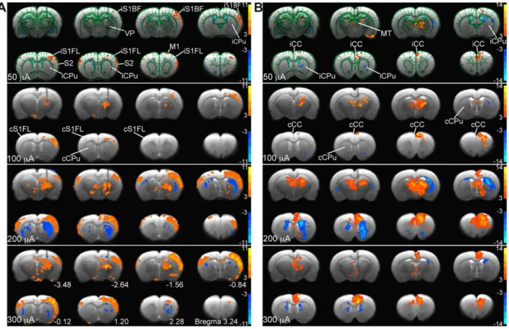 Figure 3. Intensity-dependent activity maps and region of interest analysis in the brain during VP and MT stimulation