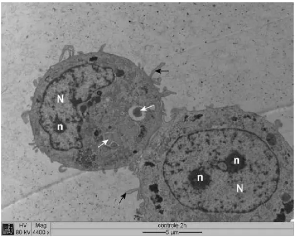 Figura 1  Eletromicrografia de cultura de células DH82  infectadas  com  .  Seta branca: 