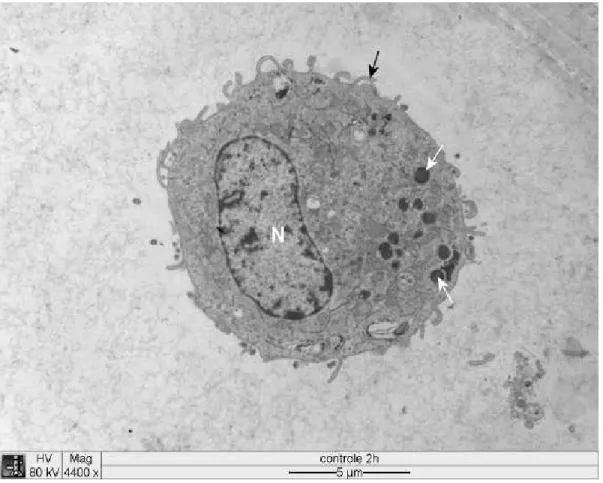 Figura 2  Eletromicrografia de cultura de células DH82 infectadas com  . Seta branca: 