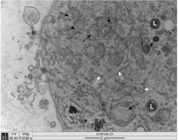 Figura 3  Eletromicrografia de cultura de células DH82 infectadas com  . Seta branca: 