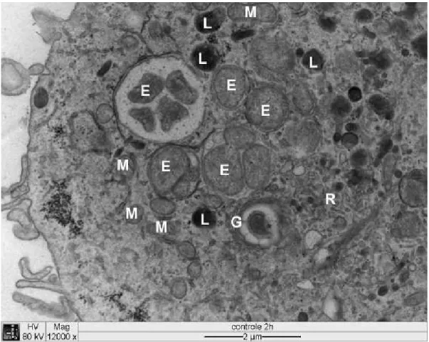 Figura 4  Eletromicrografia de cultura de células DH82 infectadas com  . E:   no                interior  de  vacúolo  parasitóforo;  L: lisossomo;  M: mitocôndria;  R: região rica  em                 retículo  endoplasmático