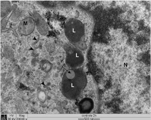Figura 5  Eletromicrografia  de  cultura  de  células  DH82  infectadas com  . N: núcleo;    