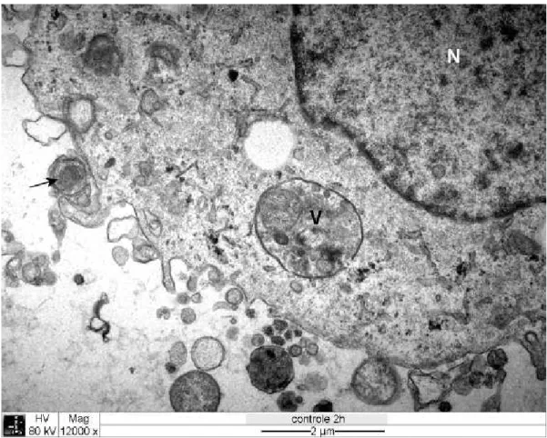 Figura 6  Eletromicrografia  de  cultura  de  células DH82 infectadas com  .  Seta  preta: 