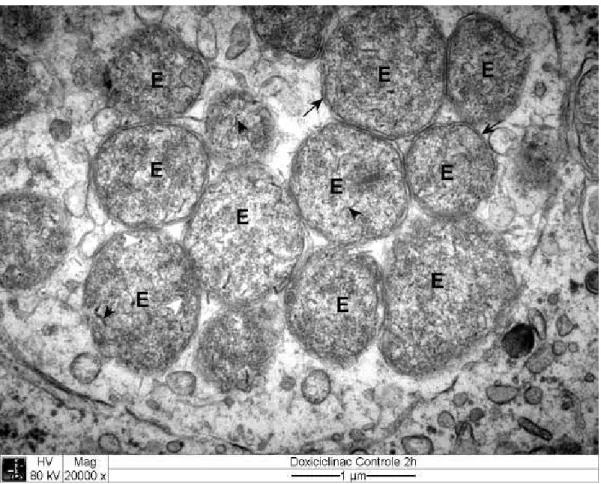 Figura 7  Eletromicrografia  de cultura de células  DH82  infectadas  com  . E:    