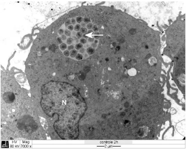 Figura 8  Eletromicrografia  de  cultura  de  células DH82 infectadas com  . Seta branca: 
