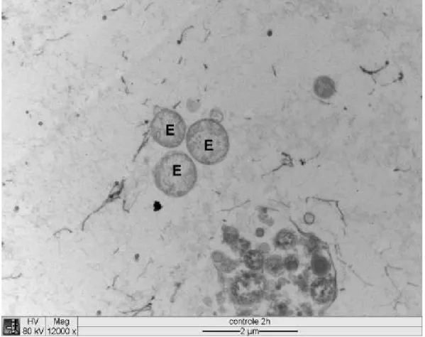 Figura 9  Eletromicrografia de cultura de células DH82 infectadas com  . E:    