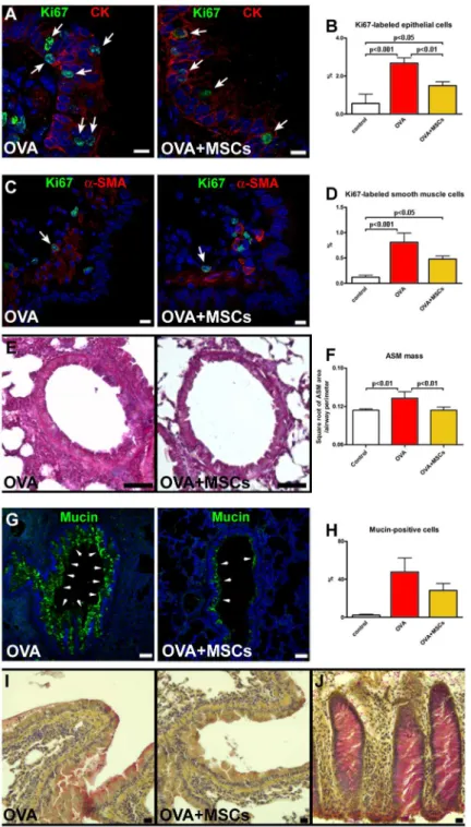 Fig 3. MSCs positively interfere with airway remodeling. (A) Proliferating (Ki67, green, arrows) epithelial cells (CK, red) in vehicle-treated and MSC-treated animals