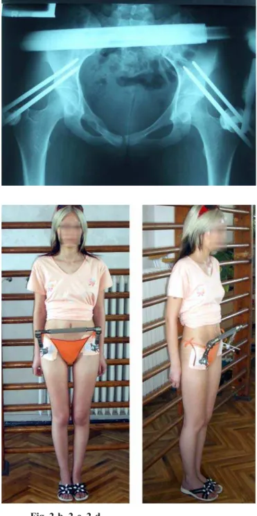 Fig. 3-b. Operative Control