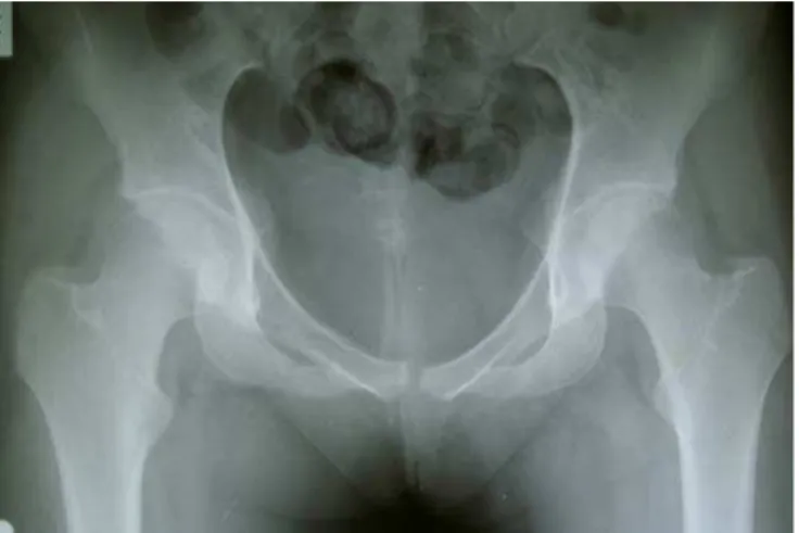 Fig. 3-d. After 18 months Case 3: