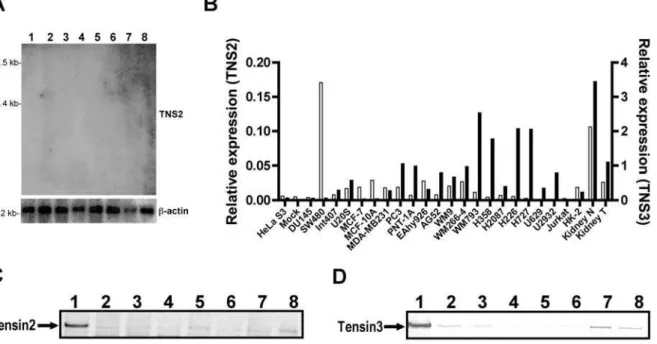 Figure 1. Absence of expression of Tensin2 and Tensin3 at both mRNA and protein levels in several different human cancer cell lines