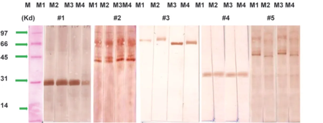Fig 4. Immunoblot against against non GM and GM maize antigens in the sera of selected 5 maize sensitized patients using sera conc