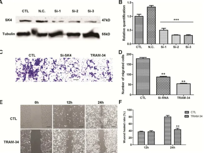 Fig 5. Down-regulation of SK4 channels inhibits the migration of MDA-MB-231 cells. A negative control siRNA (N.C.) and 3 SK4-specific siRNAs (Si-1, Si-2 and Si-3) were transfected into MDA-MB-231 cells, and 20 μM TRAM-34 was added to the TRAM-34-treated gr