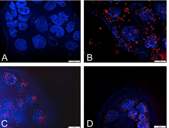 Fig 3. Evaluation of intracellular localization by fluorescence microscopy. Fluorescence visualization of nanoparticle formulations in Caco-2 cells: (A) control, (B) PLGA-DMAB-NP, (C) PLGA-DMAB-PVA-NP and (D) PLGA-DMAB-PEG-NP
