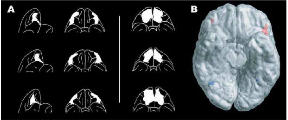 Figure 1. Reversal Learning and the Orbitofrontal Cortex