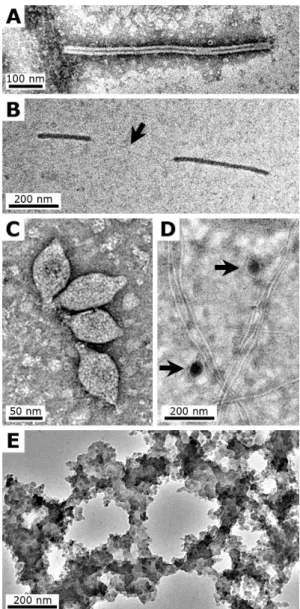 Fig. 1. (A–D): TEM micrographs showing examples of the viruses used for this study. (A) SIRV2 particle; note the central cavity, sometime discontinued