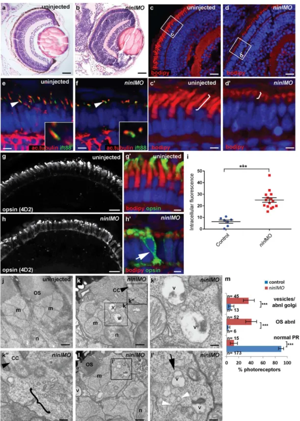 Fig 3. Zebrafish ninl knockdown causes loss of axonemes and outer segments, opsin mislocalization and vesicle/vacuole accumulation